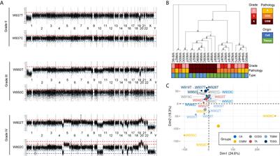 Glioblastoma Primary Cells Retain the Most Copy Number Alterations That Predict Poor Survival in Glioma Patients